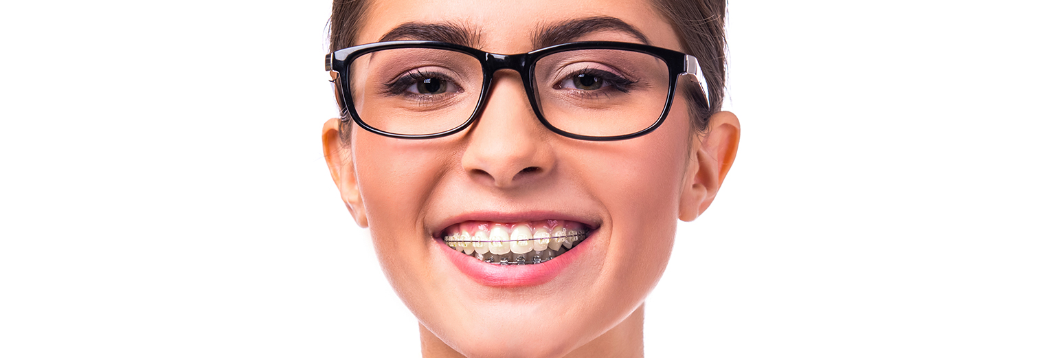 Braces in UAE
